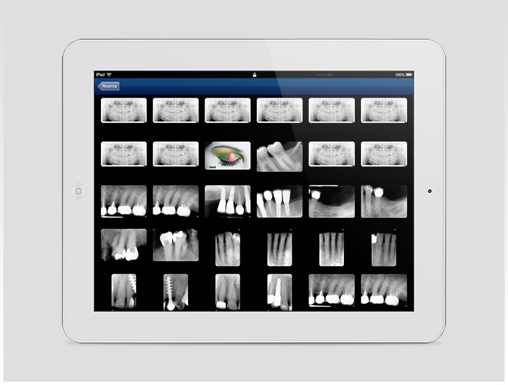 XDent iPad Edition